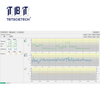 Profiler พื้นผิวถนน (RSP) 